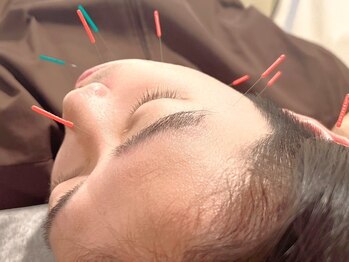 トランク鍼灸院 整骨院(TRUNK鍼灸院 整骨院)の写真/【鍼灸が初めての方◎】負担が少ない優しい鍼と温かいお灸でスッキリポカポカお身体に♪美容鍼もオススメ！