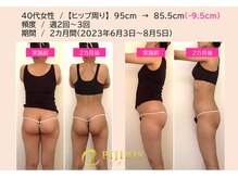 キングスサロン 熊本/美尻イスビフォーアフター