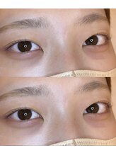 アイラッシュプラン リノ(eyelash plan RINO)/韓国風まつ毛パーマ