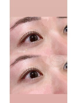 エルレ(ELRe)/ラッシュリフト