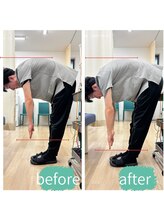 志村三丁目駅前鍼灸院 接骨院/矯正後