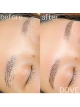 ドーヴ(DOVE)/アイブロウワックス脱毛