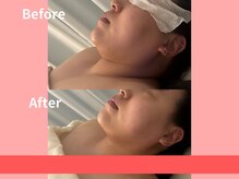 リライブ 亀有店(Re:Lives)/小顔美肌のお客様の口コミ♪