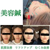 やまぐち鍼灸整骨院 千里山院