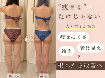 プライベートサロン タンタン(tantan)の写真