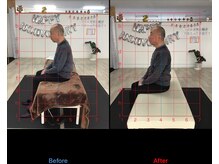 ストレチックス 近江八幡店/姿勢改善ビフォーアフター1回