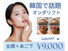 パルティール(PARTIR)