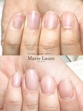マリーロール 梅田店(Marie Laure)/自爪育成/深爪矯正/ネイルケア