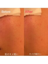 凪 横浜/肌を表面と内側両方デトックス
