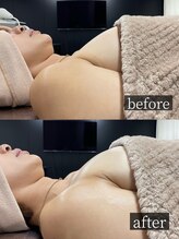 エーアイビューティー 御徒町店(Ai Beauty)/ 【バストアップ例】