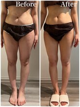 リッシュボーテ(RICHE BEAUTE)/【広尾/リンパマッサージ/痩身】