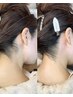 【一回で綺麗なうなじケア】うなじWAX/鎮静クリーム付　¥5,000