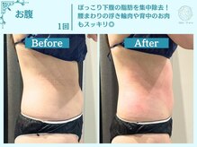 フローフシ∞/お腹の脂肪をスッキリと