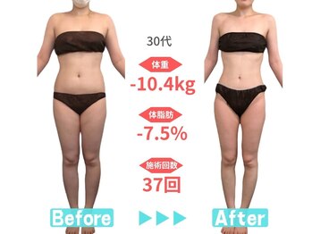 ビースタイル 春日井店(B'style)/30代マイナス10キロ