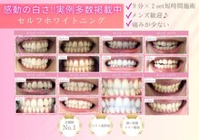 エクシアホワイトニング 倉敷店