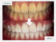 エマ 大橋店(emma)/before/after