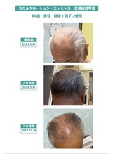 スキンラボ カホクカイ(KaHokuKai)/白髪変化注目です