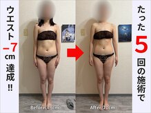 ぷりんす整体コージー(COZY)/【30代 女性】ビフォーアフター