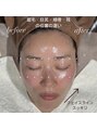 ゼアー(THERE FY.) フェイシャル・美頭筋スパで骨格整え3D小顔リフトUP叶えます♪