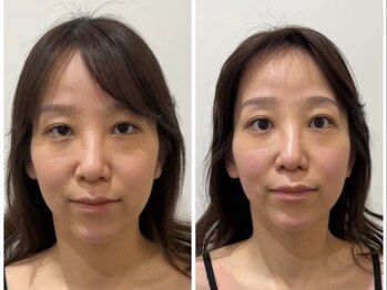ドクターボディクリスタル(Dr.Body Crystal)/20代