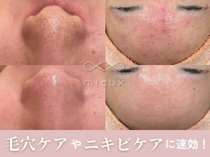 ミュー 本町店(mieux)の写真