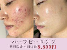 ホリホック
