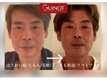スパ 香炉の写真/第一印象は肌で変わる！リフトアップと肌質改善を同時に実現◎たるみ・シワ改善に挑む最先端メンズケア。