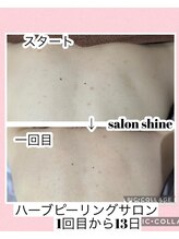 サロンシャイン(Salon Shine)/背中のハーブピーリング