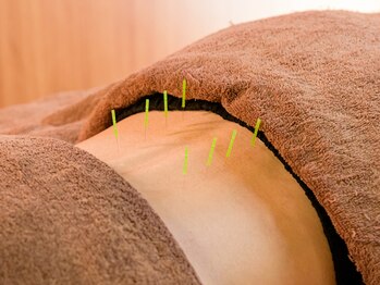 メディカルエステ 田奈鍼灸院/腰痛には鍼が良いです