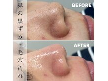 ベレア(BELEA)の雰囲気（お肌に優しい美容成分入りワックス使用♪）