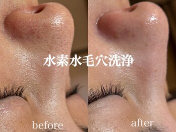 ネオリー(neorii)/水素水毛穴洗浄