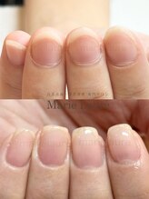 マリーロール 梅田店(Marie Laure)/深爪矯正/自爪育成/自爪風