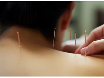 もんたわ鍼灸整骨院/腰痛・肩こり・頭痛でお悩みの方