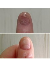 なかやまネイルクリニック/