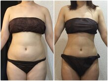 美容整体ウェリナ あま甚目寺院/小顔矯正/骨盤矯正/美脚サロン