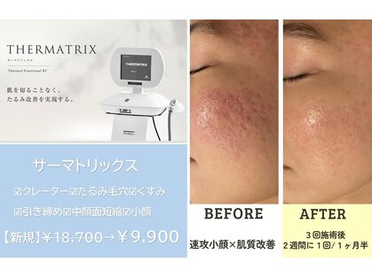 ラピス 新宿の写真