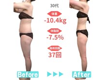 ビースタイル 春日井店(B'style)/30代マイナス10キロ