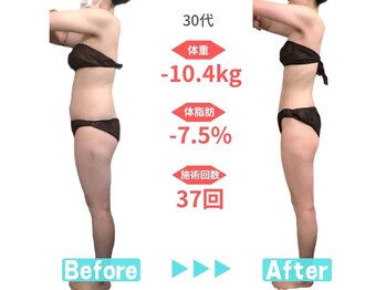 ビースタイル 春日井店(B'style)/30代マイナス10キロ