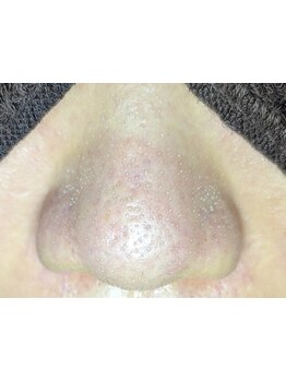 お肌をきれいにしたい