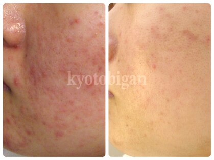 京都美顔の写真