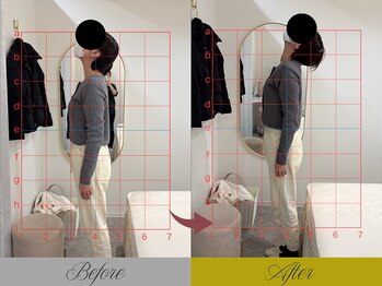 リン 大宮院(RIN)/骨膜整体での変化（担当：荒木）