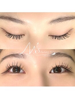 ミス(M's)/バインド80束