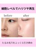 【最高峰のエイジング】次世代肌育PDRN(サーモン成分)導入!年齢肌・毛穴に