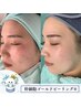 肌管理人気No,2★塗る金の糸を超える肌質改善術◎美肌を長くキープ