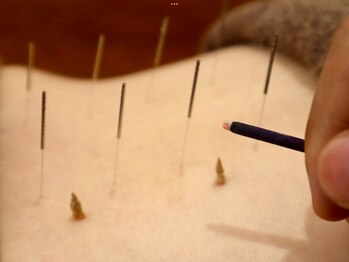 あらき鍼灸整体院の写真/【腰痛にも特化♪】エアコンの冷えによる腰痛増加！特に同じ姿勢が続く方要注意！あらゆるお悩みに特化☆