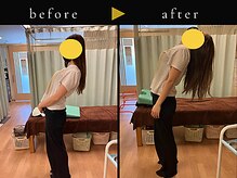 杉本接骨鍼灸院/腰椎ヘ○ニアが楽になりました！