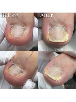 巻き爪補正店 横浜駅前店/