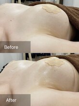 エーアイビューティー 御徒町店(Ai Beauty)/ 【バストアップ例】