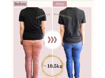 えのもと美容整体院/30代女性