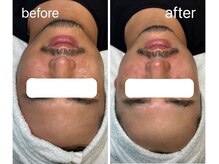 ベルエス(bell.s)/メンズもOK